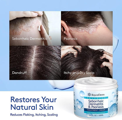 Soothing Scalp Relief Cream™